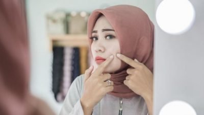 Cara Menghilangkan Jerawat Serta Pencegahannya