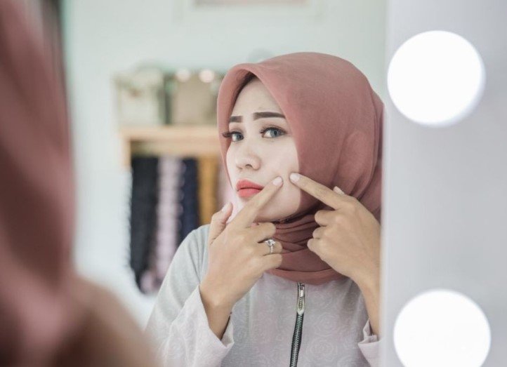 Cara Menghilangkan Jerawat Serta Pencegahannya