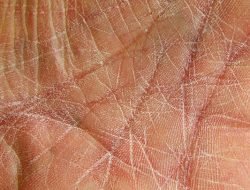 6 Tips Atasi Kulit Kering Saat Musim Dingin
