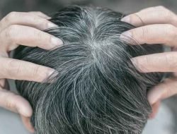Fakta Menarik Seputar Rambut Beruban