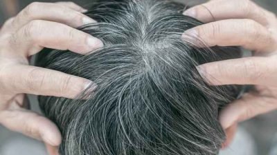 Fakta Menarik Seputar Rambut Beruban