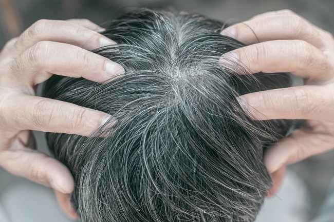 Fakta Menarik Seputar Rambut Beruban