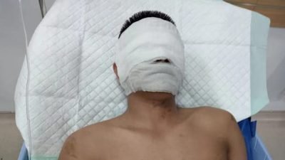 IPW dukung Komunitas Jurnalis atas kejanggalan kematian rekannya paska meliput Perjudian